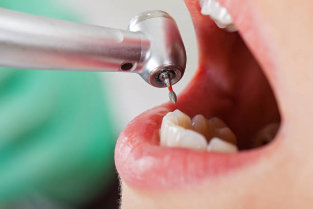 Best Emergency TMJ Treatment in Gadsden, AL